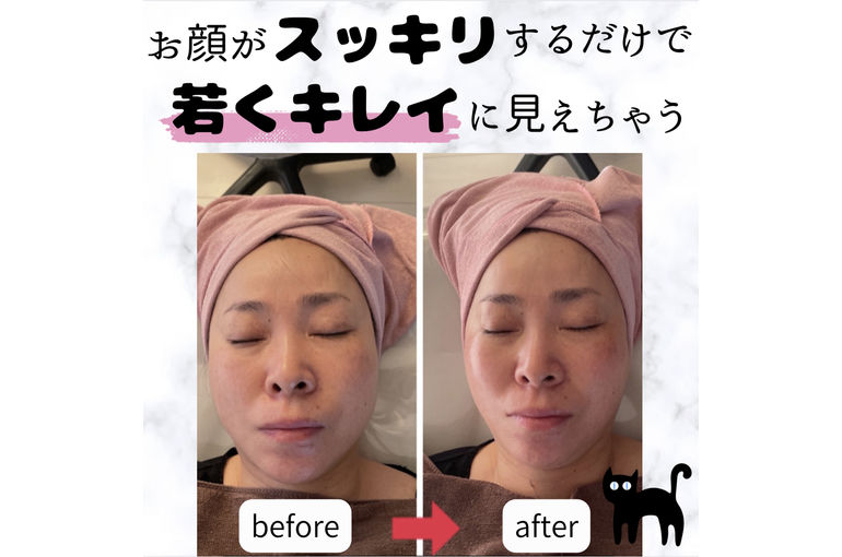 若くキレイ