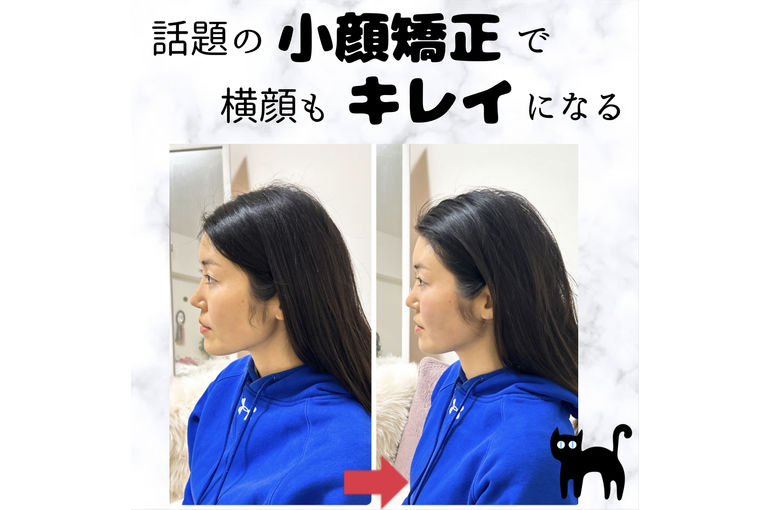 横