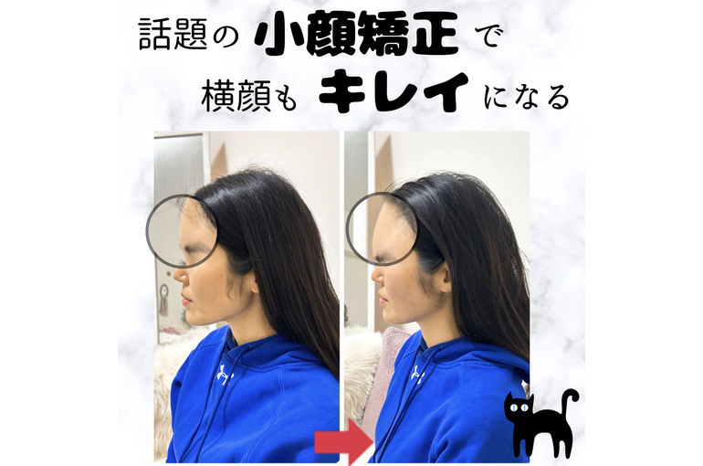 オデコ