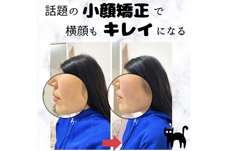 口元