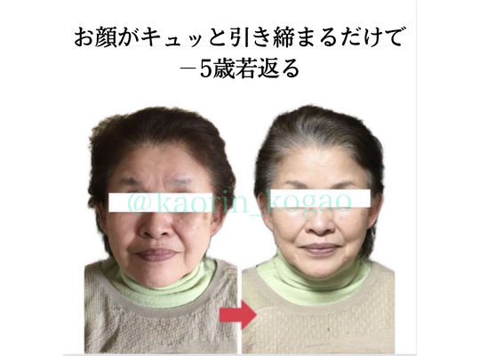 キレイ