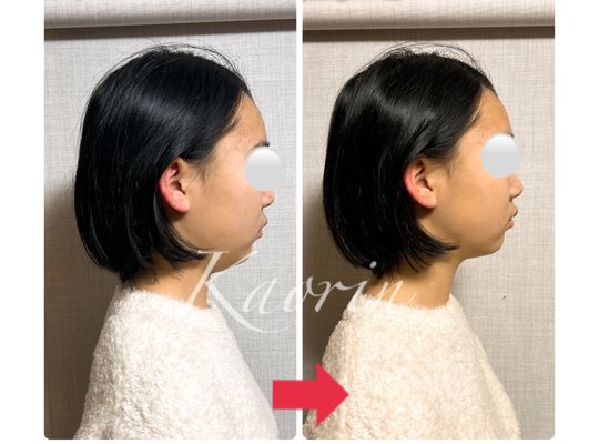 ビフォーアフター