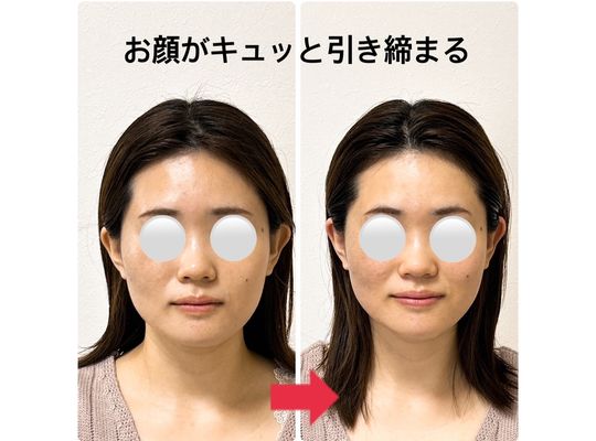 小顔