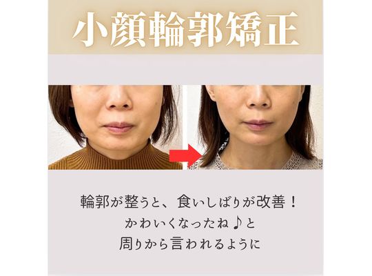 30代