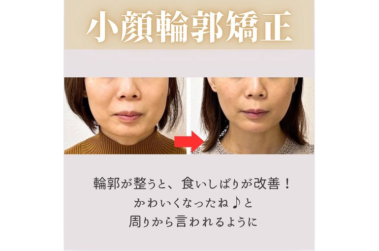 30代