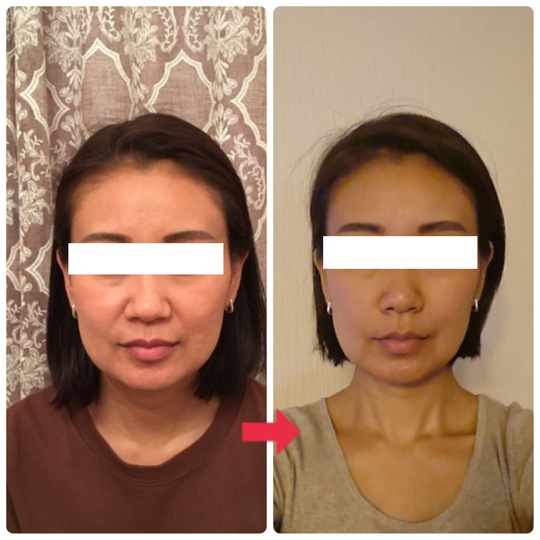 ビフォーアフター画像