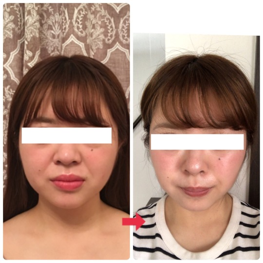 ビフォーアフター画像