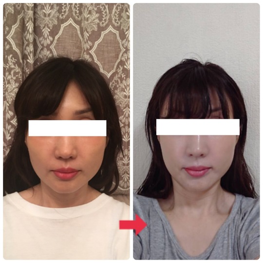 50代女性ビフォーアフター