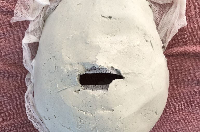 結婚式前には小顔矯正 石膏パックがおススメ